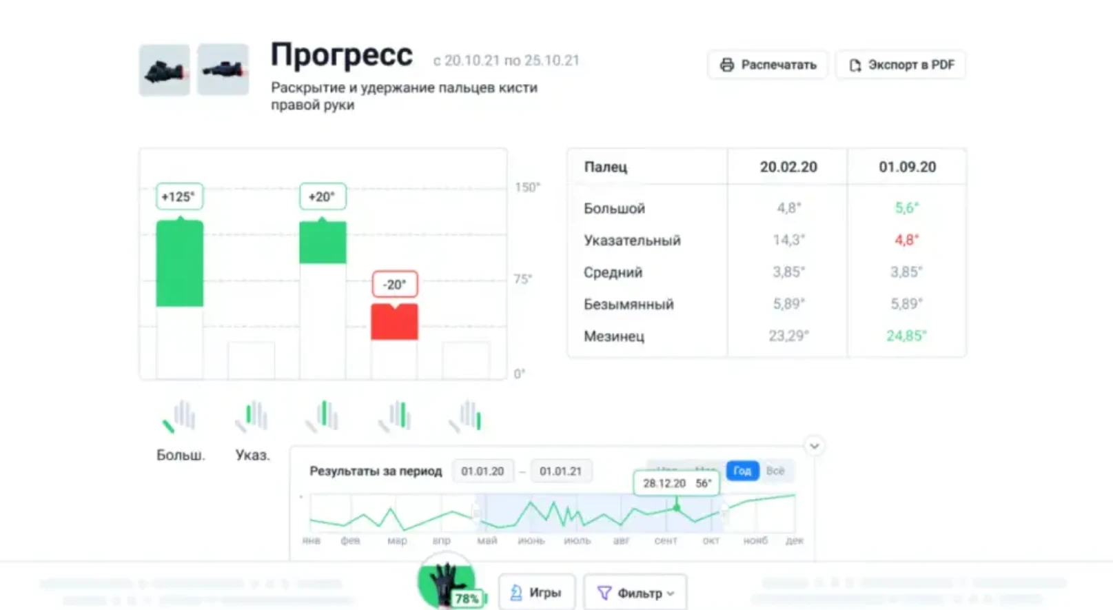 Перчатка-тренажер SensoRehab эффект